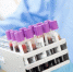 Поровну заболело и выздоровело от CoViD-19 в Мурманской области - ИА B-Port.Com