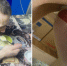 Покалеченного ветерана СВО забрали на лечение из приюта - SeverPost.ru