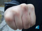 В борьбе с зеленым змием кандалакшанин спустил с лестницы мужчину